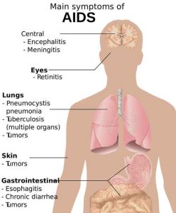 Myths About Hiv